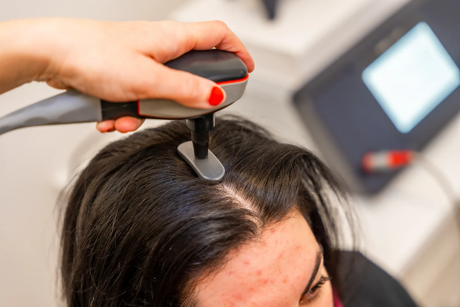 Haarwachstum-Behandlung mit Spezialgerät im ADEVE Salon